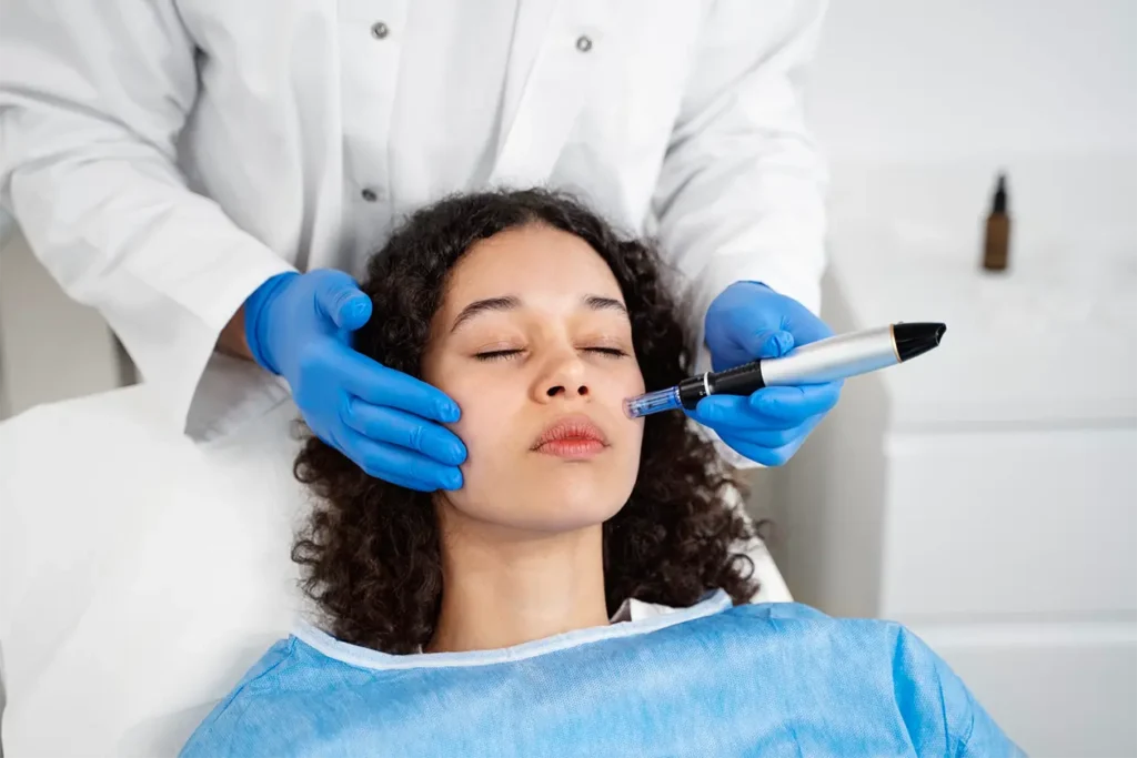 microneedling